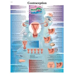 Planche anatomique - CONTRACEPTION